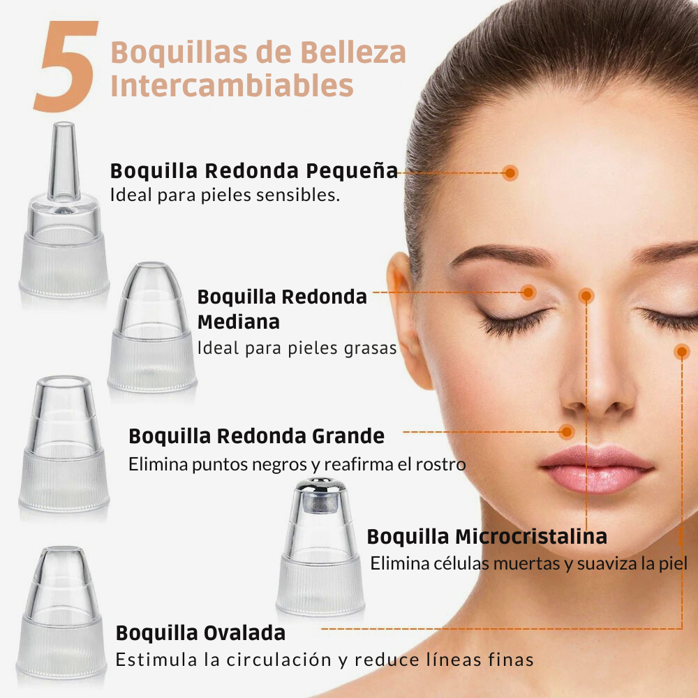 Removedor de Puntos Negros con Succión – Limpieza Facial Profunda y Microdermoabrasión Portátil