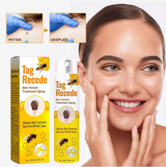 Spray Removedor Natural de Verrugas y Marcas de Piel con Veneno de Abeja
